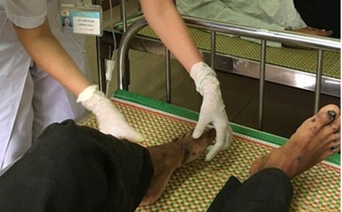 Bộ Y tế yêu cầu giám sát “bệnh lạ” tái xuất tại Quảng Ngãi