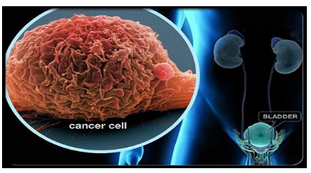 10 loại thực phẩm càng ăn càng “nuôi” ung thư