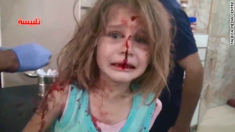 Thêm hình ảnh gây chấn động của bé gái Syria bị trúng bom