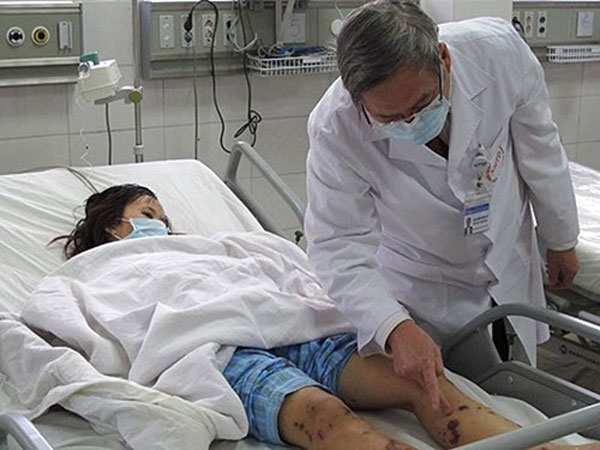 Ổ dịch viêm não mô cầu tại Hà Nội đã được khống chế
